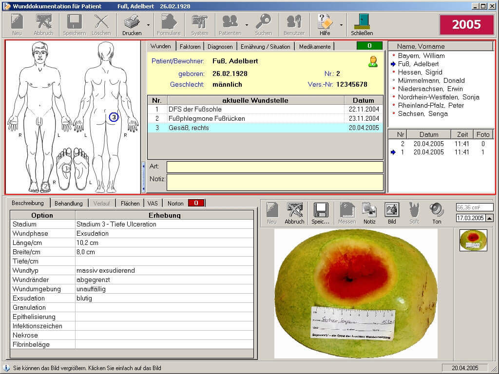 WinDia - Wunddokumentation - Screenshot - MAGISA - Berlin - Brandenburg